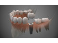 allure-dental-small-0